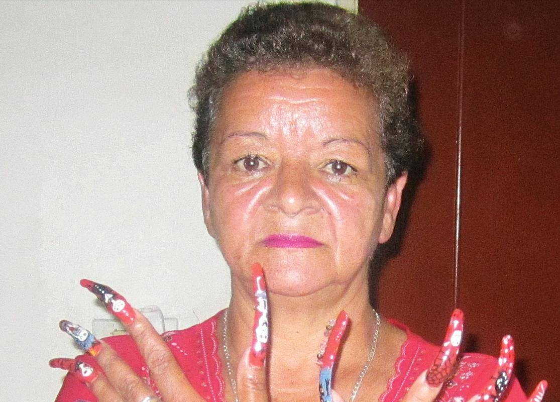 16. Qué uñas tan largas: al momento de la foto, las uñas de Margarita Marulanda, oriunda de La Estrella, medían 7 centímetros. Llevaba un año sin cortárselas.