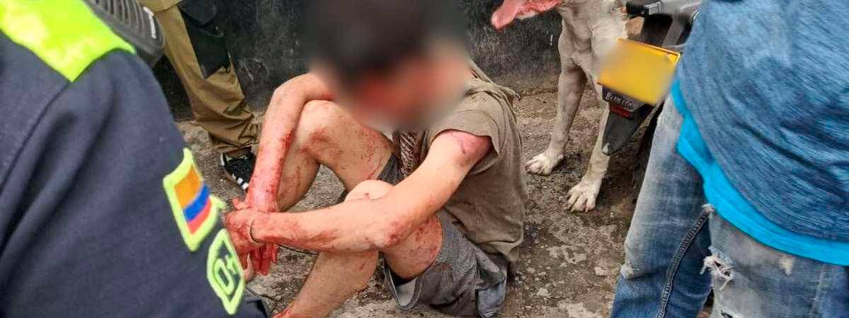 Lo golpearon entre 15 personas con tablas, puños, patadas y hasta correas. /FOTO: CORTESÍA