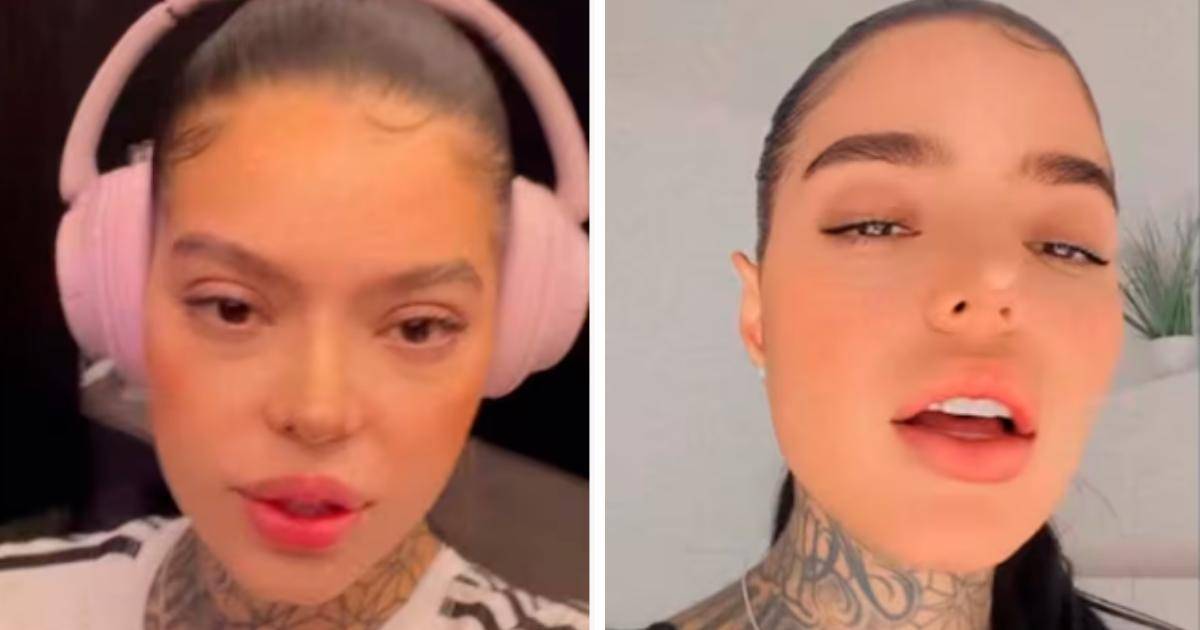 Así quedó Melissa Gate tras la rinoplastia. <b><span class=mln_small-caps_mln>/FOTOS: TOMADAS DE VIDEO</span></b>