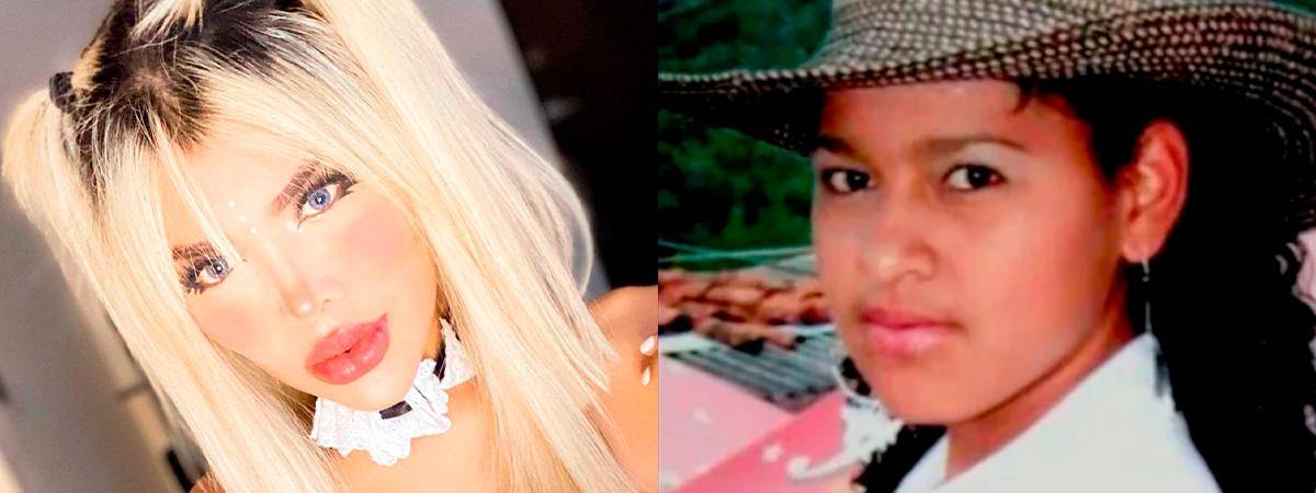 El antes y el después de la Barbie Colombiana. /FOTOS: TOMADAS DE LA WEB