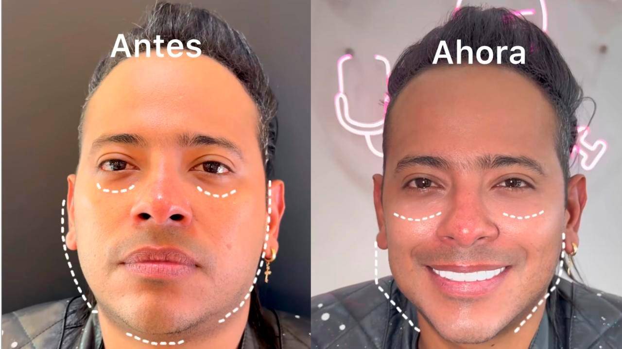 Ese es su antes y después.