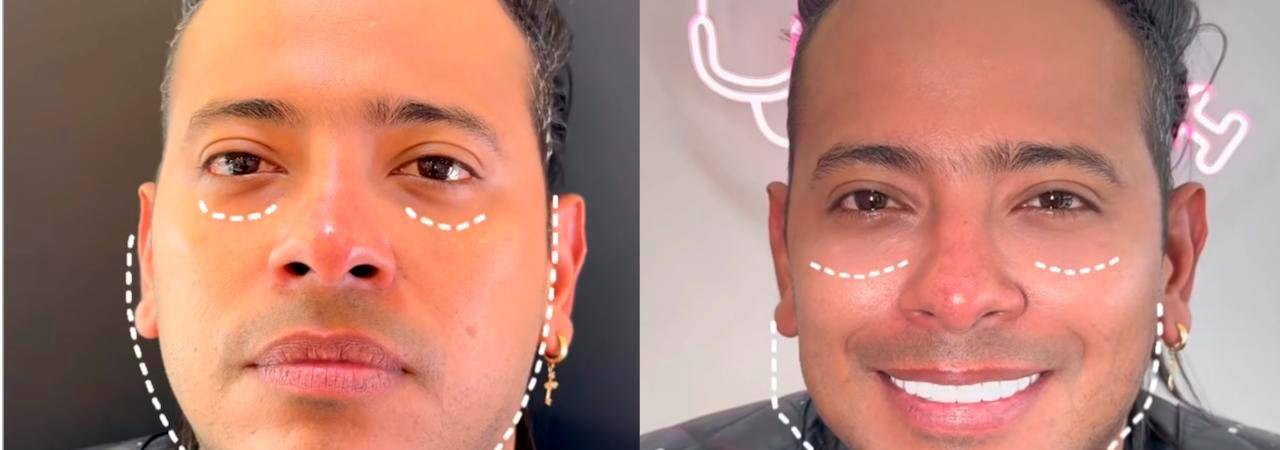 Ese es su antes y después. 