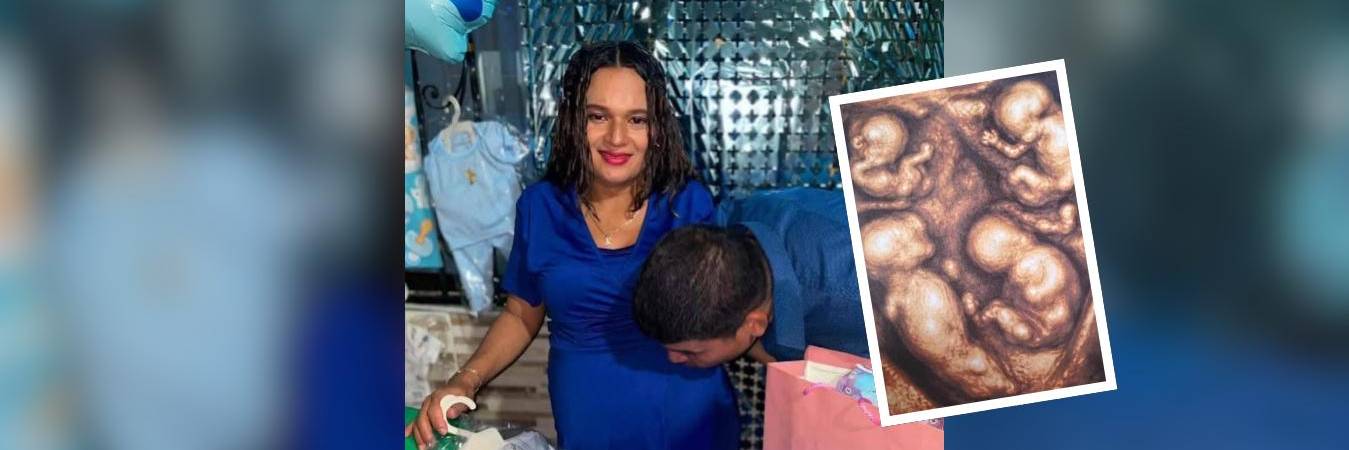 María Tapia y Jonatan Zapa, pareja de Caucasia que espera cuatrillizos idénticos. FOTO: REDES SOCIALES