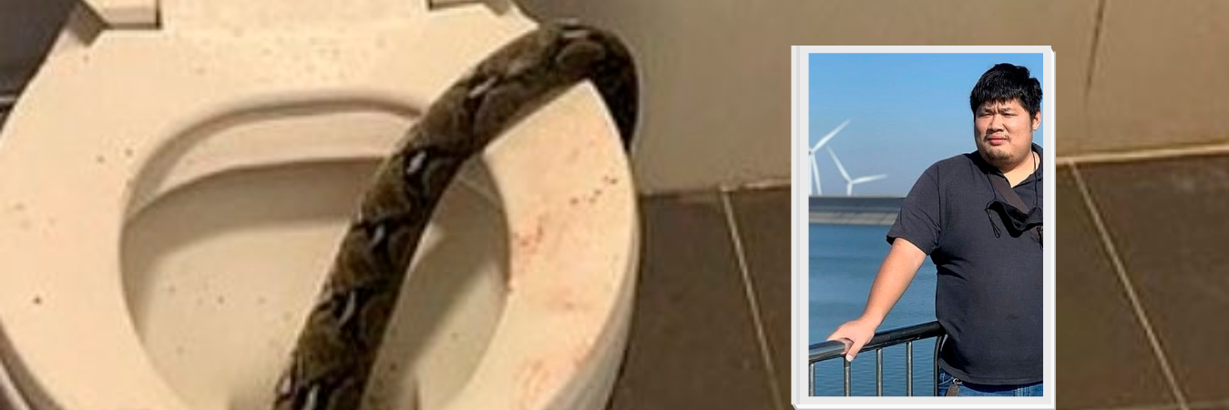 En el hospital le dijeron que afortunadamente la mordida no era muy profunda. / FOTO: @UPUKNEWS1