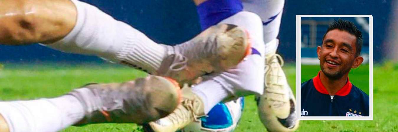 IMÁGENES SENSIBLES: Escalofriante lesión de Hobbit Bermúdez estremece al  fútbol