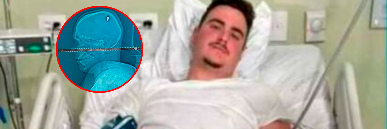 Este es Mateus Facio, quien resultó herido por una bala en su cabeza. /FOTO: Q’HUBO BUCARAMANGA 