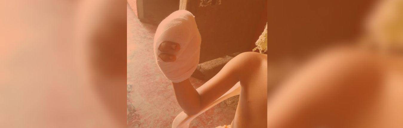 Imagen QUEMADOS POLVORA ANTIOQUIA BANNER