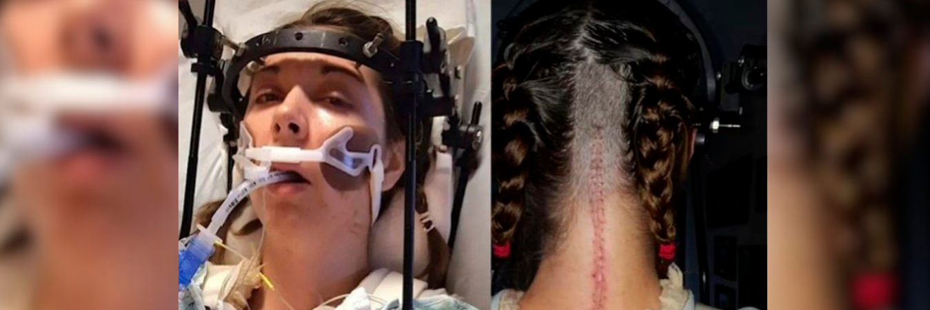 Así se ve el rostro y la zona del cuello de la mujer tras las cirugías a las que ha sido sometida. /FOTOS: TOMADAS DE LA OPINIÓN.