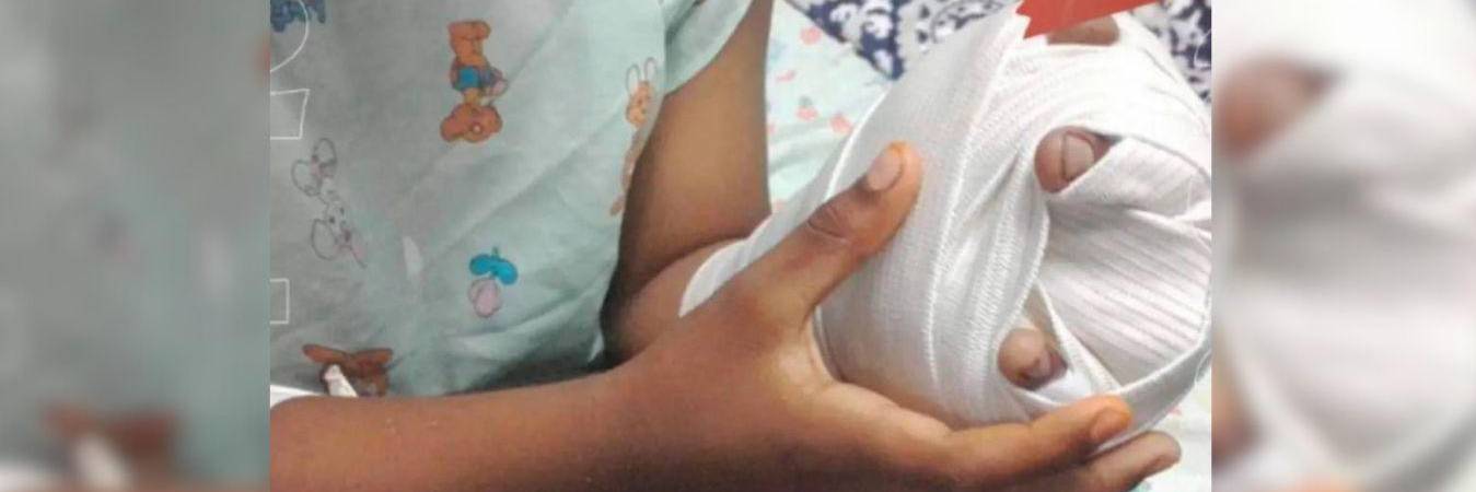 Un bebé de tan solo 10 meses fue atendido en un centro asistencial luego de sufrir quemaduras de segundo grado. FOTO: COLPRENSA