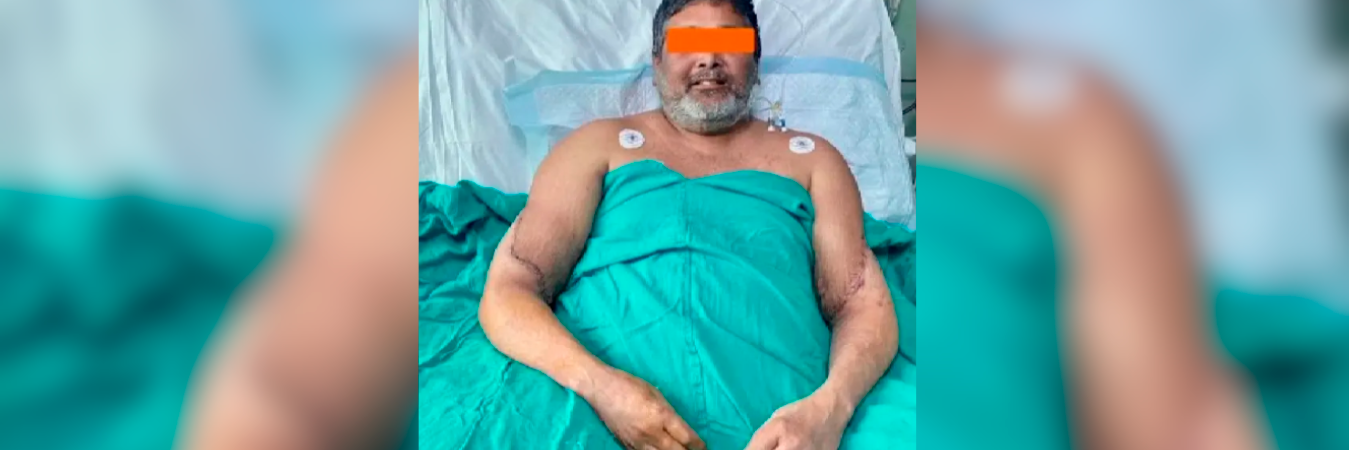 Doce horas se demoraron 15 médicos uniendo articulaciones, nervios y demás partes para que el trasparente de manos fuera exitoso. /FOTO: TOMADA DE LA WEB