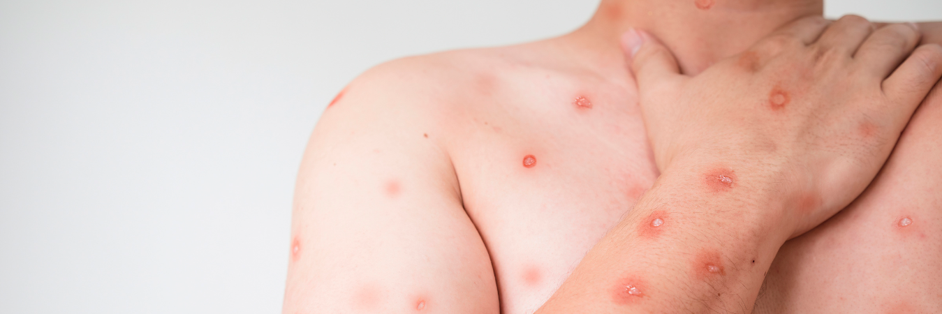 Imagen para ilustrar la nota. / FOTO: CANVA.