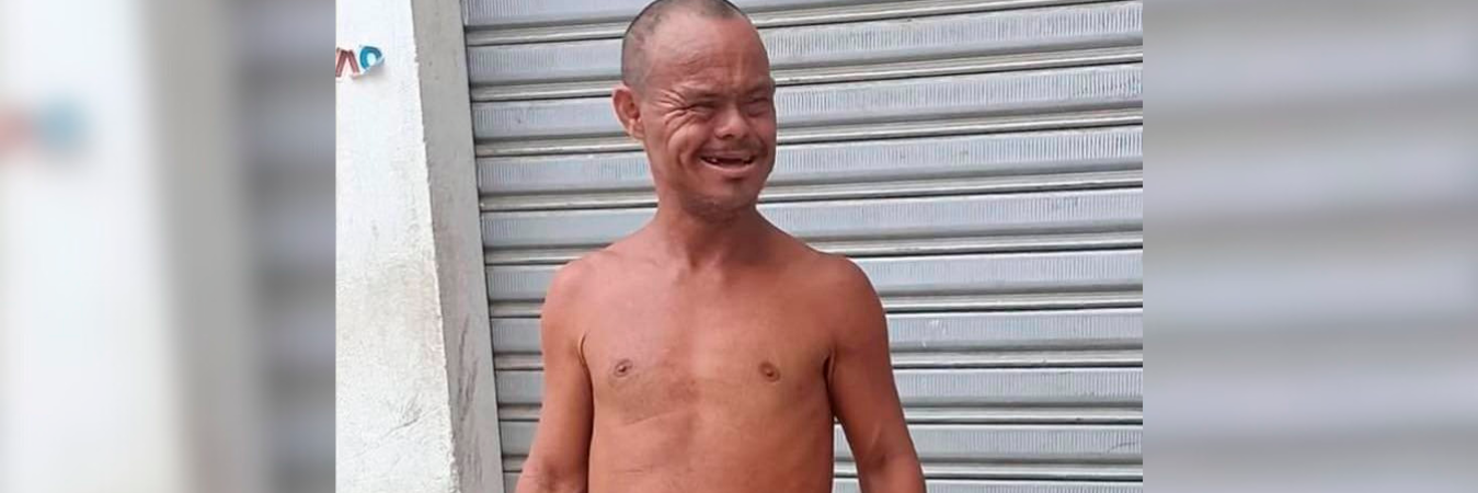 El Míster era un habitante en condición de calle muy querido en Turbo. Nadie se explica por qué lo mataron. /FOTO: URABÁ SIN LÍMITES - ÚNICA OFICIAL.