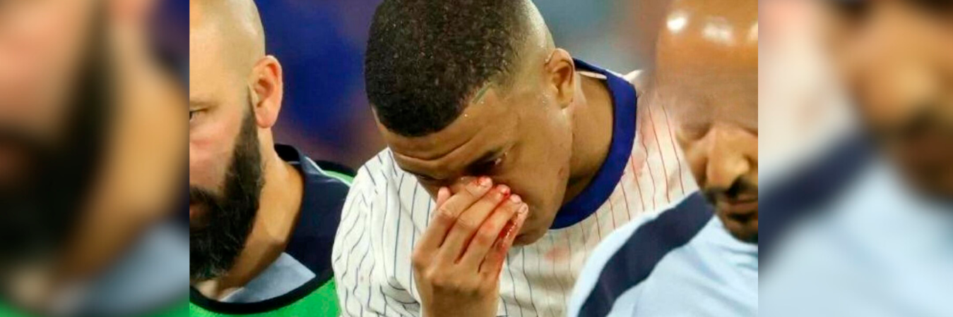 Momento en el que Kylian Mbappé tuvo que salir del terreno de juego lastimado. /FOTO: X @mdzol