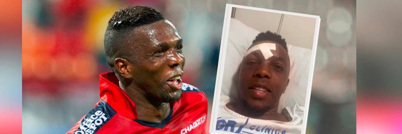 El exfutbolista se chocó cuando iba en su moto. / FOTOS: MANUEL SALDARRIAGA Y REDES.