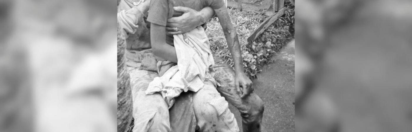 Este es uno de los menores que resultó gravemente herido. Allí, esperaba su traslado a Medellín. /FOTO: CORTESÍA ANDRÉS JULIÁN RENDÓN