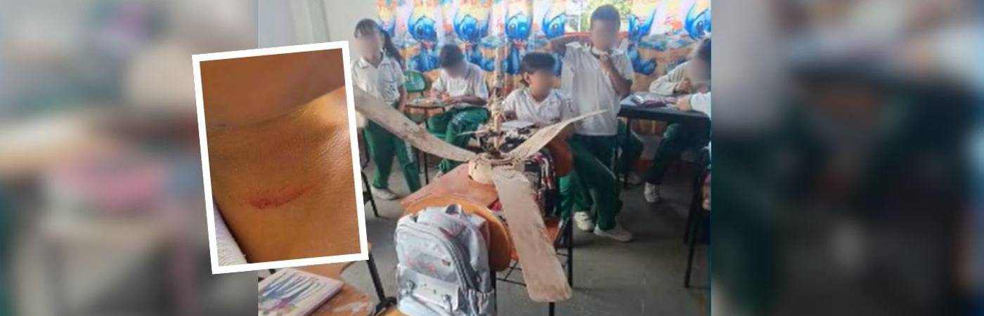 Dos estudiantes resultaron levemente heridos por las aspas del artefacto. FOTOS: TELEMEDELLÍN