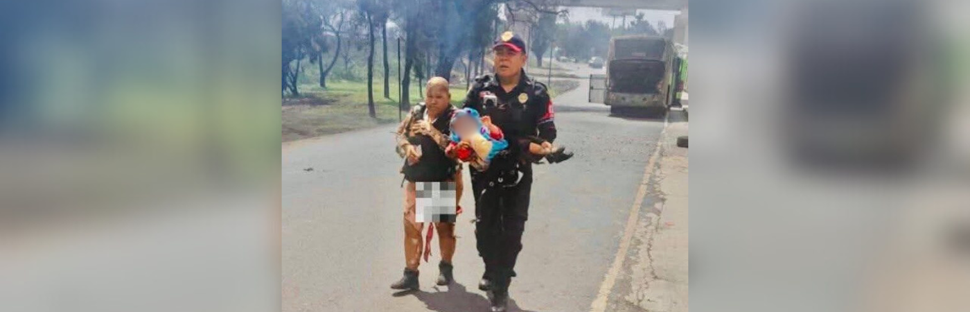 Abuela y nieta con quemaduras tras la explosión en México. /FOTO: REDES SOCIALES