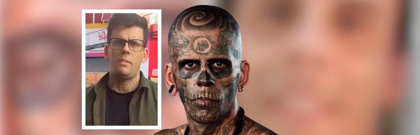 Al escuchar su historia, un especialista decidió regalarle el tratamiento láser. FOTO: INSTAGRAM @LEONARDODESOUZABLESS