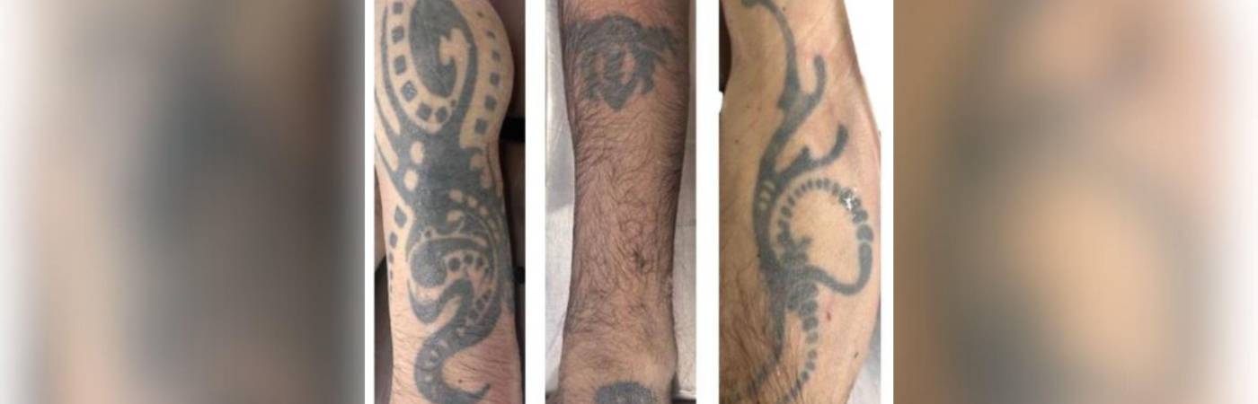 El hombre, quien no ha sido identificado, tiene estos tatuajes en los brazos. FOTO: MEDICINA LEGAL
