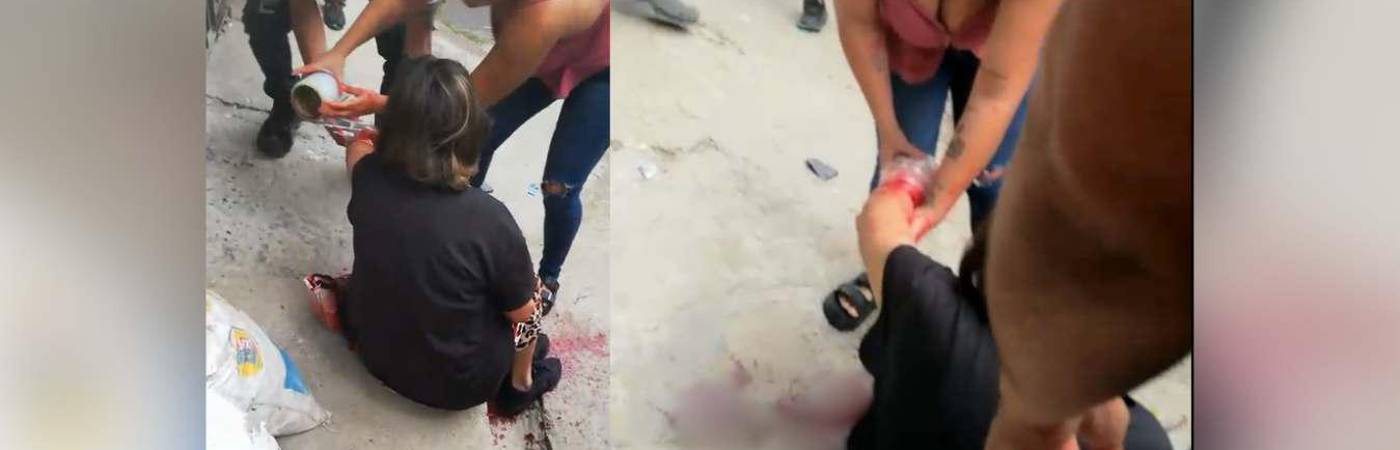 Adulta mayor resultó herida por bala perdida tras riña en Bello