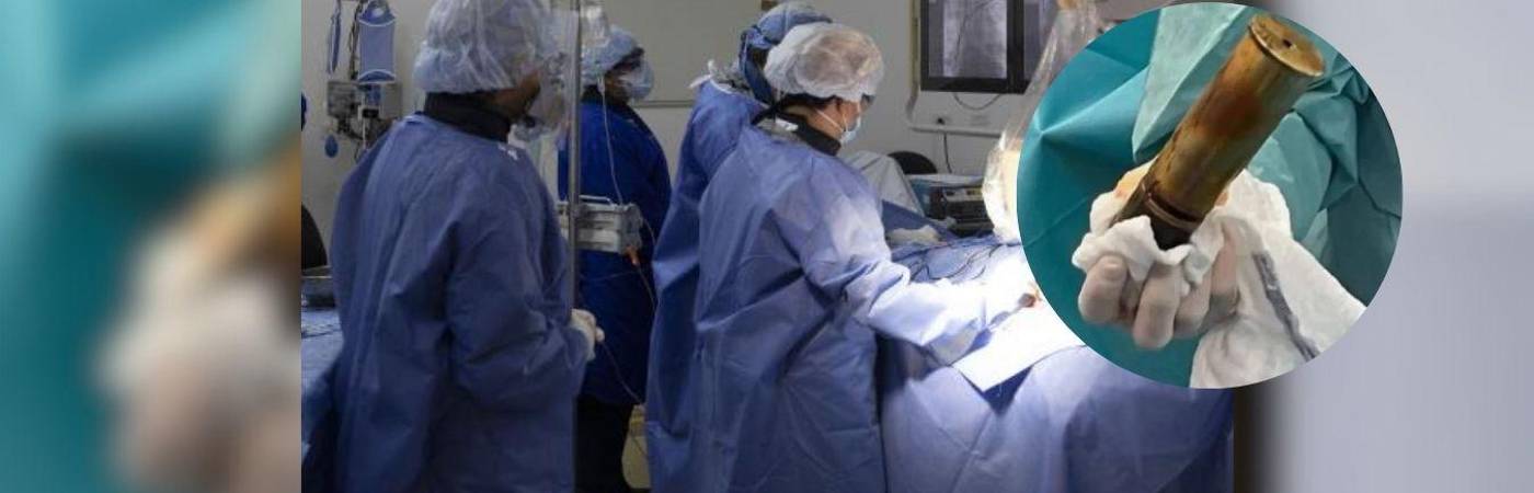 ¡Increíble! Un joven llegó a urgencias con una granada en el recto