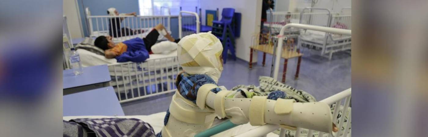 65 menores de edad han resultado quemados entre diciembre de 2024 y lo que va de 2026. FOTO: COLPRENSA