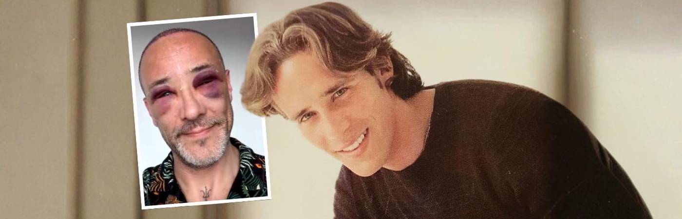 Foto principal: Ricardo Herrera cuando interpretó a JP en ‘Padres e hijos’. Detalle: el actor tras su último tratamiento capilar. FOTOS: INSTAGRAM @ricardoherreraneira