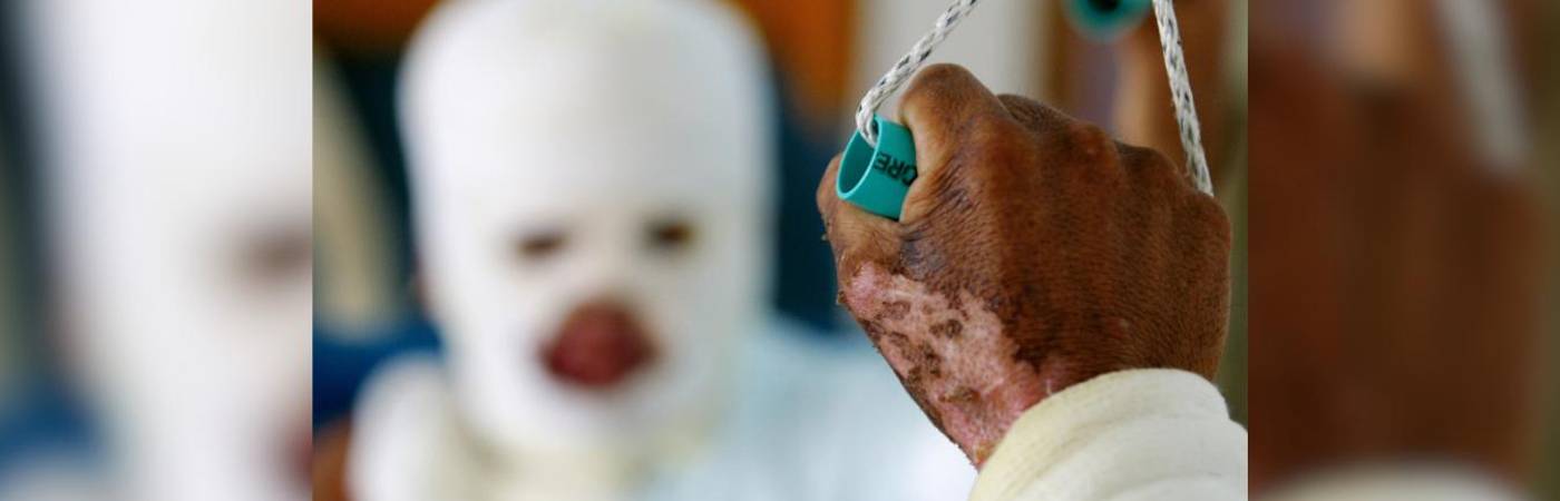 La víctima estuvo bajo observación médica por 2 semanas. FOTO: ARCHIVO EL COLOMBIANO