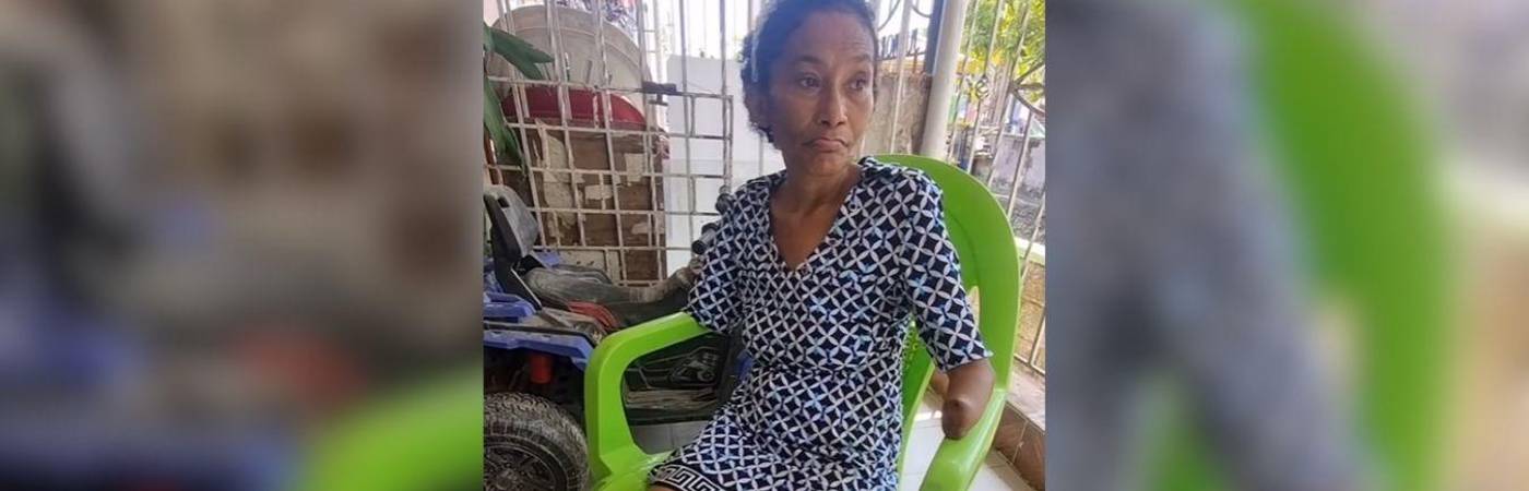 Después de mes y medio en coma despertó con manos y pies negros, lo cual hizo necesario amputar. FOTO: CAPTURA DE VIDEO EMISORA ATLÁNTICO