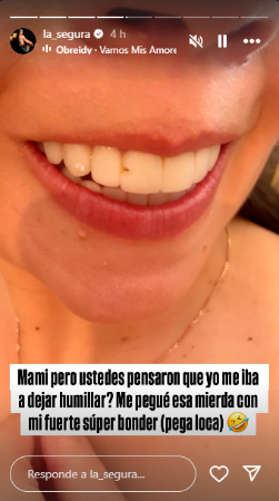 Así le quedó el diente con pega loca. FOTO: INSTAGRAM @LA_SEGURA