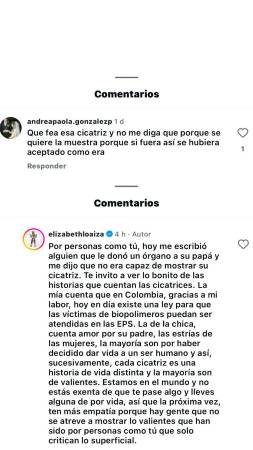 “Ten más empatía”: Elizabeth Loaiza respondió a quien criticó la cicatriz de sus glúteos 
