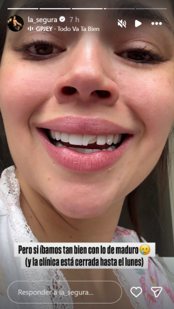 Así le quedó el diente cuando se lo quebró. FOTO: INSTAGRAM @LA_SEGURA