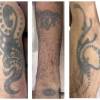 El hombre, quien no ha sido identificado, tiene estos tatuajes en los brazos. FOTO: MEDICINA LEGAL