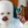 La víctima estuvo bajo observación médica por 2 semanas. FOTO: ARCHIVO EL COLOMBIANO
