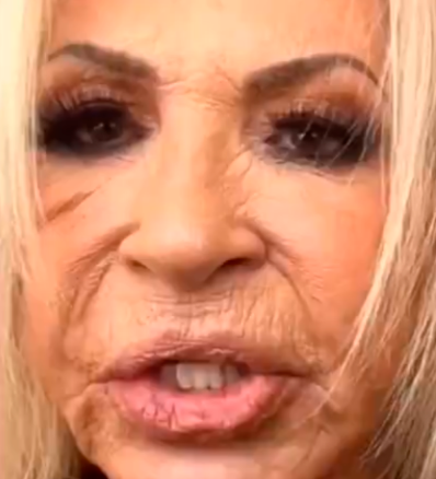 Así lucía Laura Bozzo antes del procedimiento estético. /FOTO: REDES SOCIALES