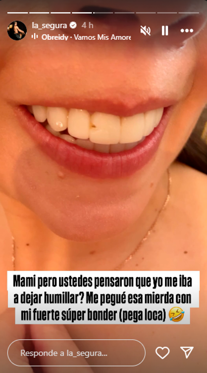 Así le quedó el diente con pega loca. FOTO: INSTAGRAM @LA_SEGURA