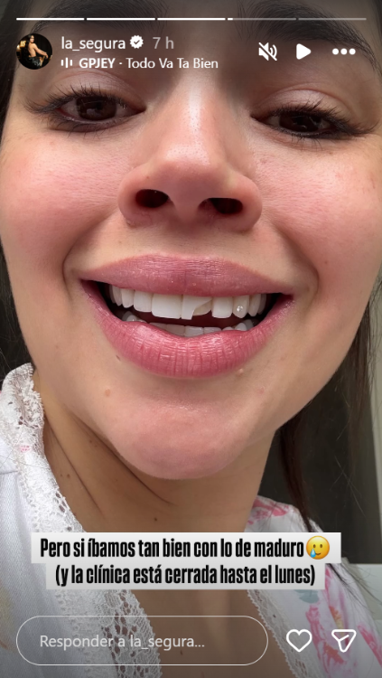 Así le quedó el diente cuando se lo quebró. FOTO: INSTAGRAM @LA_SEGURA