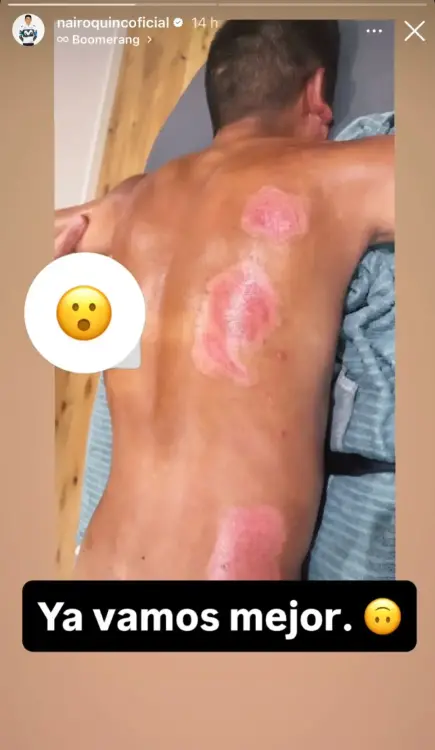 / FOTO: INSTAGRAM @nairoquincoficial