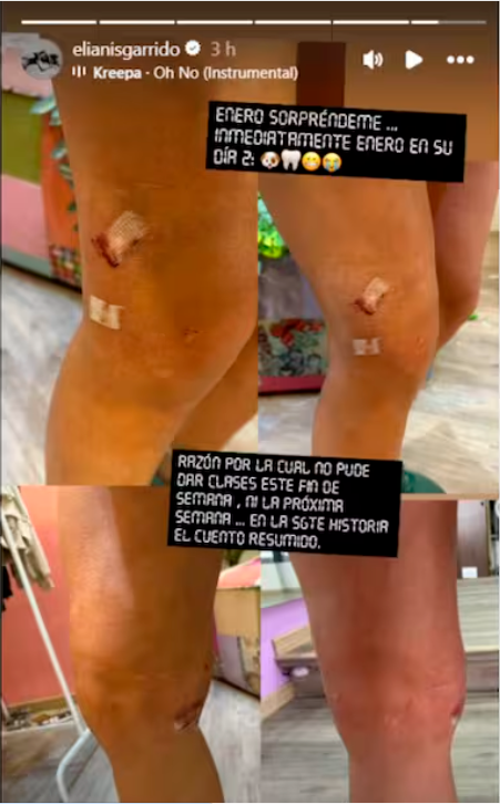 La presentadora publicó las fotos en sus historias y contó qué fue lo que pasó entre sus mascotas. / FOTO: @ELIANISGARRIDO