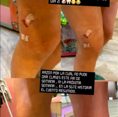 La presentadora publicó las fotos en sus historias y contó qué fue lo que pasó entre sus mascotas. / FOTO: @ELIANISGARRIDO