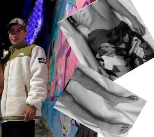 Según las fotos tomadas tras su muerte (der.) Andrés Felipe López Bedoya había perdido mucha masa muscular. FOTOS: TOMADAS DE EL COLOMBIANO