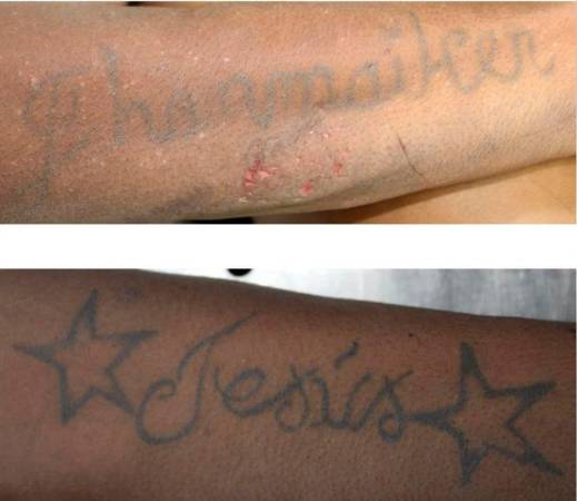 Con estas fotografías la entidad forense busca a los familiares de este hombre. /FOTO: CORTESÍA.