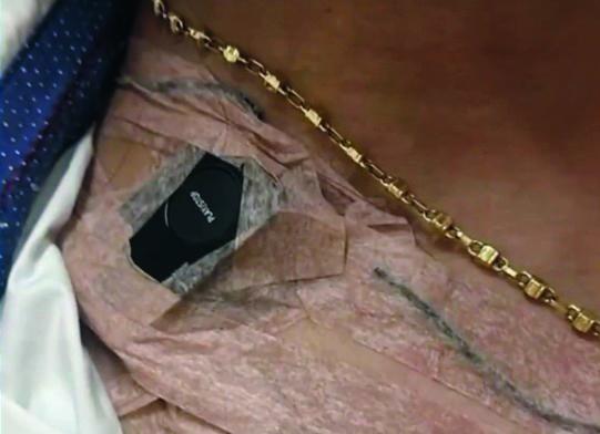 Este fue uno de los dispositivos tecnológicos que usaron los profesionales durante la prueba. FOTO: CORTESÍA