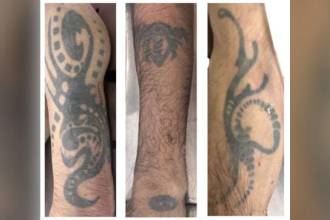 El hombre, quien no ha sido identificado, tiene estos tatuajes en los brazos. FOTO: MEDICINA LEGAL