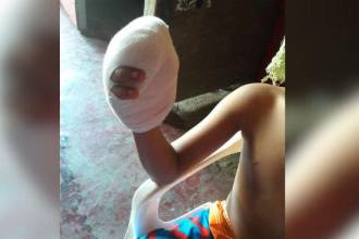 El menor está siendo atendido en un centro asistencial y los padres seguramente tendrán que rendir cuentas a las autoridades. Imágen de archivo para ilustrar la nota. FOTO ARCHIVO Q’HUBO