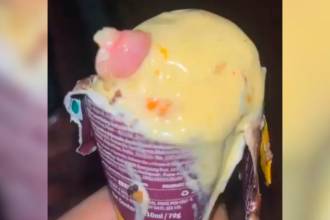 El hombre llevó la parte del dedo a la Policía para que lo investiguen. /FOTO: CAPTURA DE VIDEO