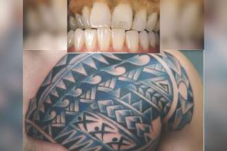 La dentadura y el tatuaje del hombre fallecido que permanece en Medicina Legal sin ser identificado. FOTOS: CORTESÍA MEDICINA LEGAL