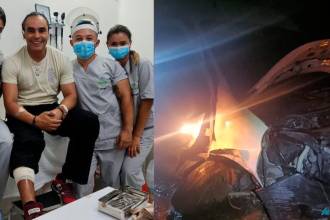 El integrante Joe fue uno de los más afectados y requirió atención médica especializada. FOTOS: INSTAGRAM @zonaprieta