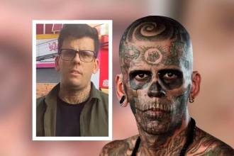 Al escuchar su historia, un especialista decidió regalarle el tratamiento láser. FOTO: INSTAGRAM @LEONARDODESOUZABLESS