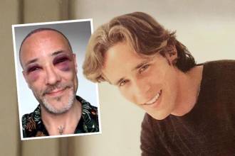 Foto principal: Ricardo Herrera cuando interpretó a JP en ‘Padres e hijos’. Detalle: el actor tras su último tratamiento capilar. FOTOS: INSTAGRAM @ricardoherreraneira